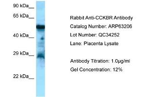 Western Blotting (WB) image for anti-Cholecystokinin B Receptor (CCKBR) (C-Term) antibody (ABIN2789413) (CCKBR 抗体  (C-Term))