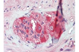 Immunohistochemistry (Paraffin-embedded Sections) (IHC (p)) image for anti-Heat Shock Protein 90kDa alpha (Cytosolic), Class B Member 1 (HSP90AB1) (AA 250-325) antibody (ABIN615278)