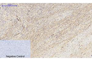 Immunohistochemical analysis of paraffin-embedded human uterus tissue. (MEK1/2 抗体)