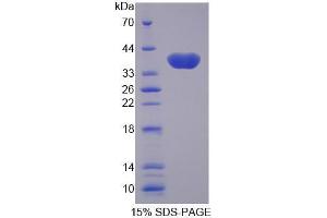 Image no. 1 for Solute Carrier Family 25 (Mitochondrial Carrier, Oxoglutarate Carrier), Member 11 (SLC25A11) (AA 1-314) protein (His tag) (ABIN6239635) (SLC25A11 Protein (AA 1-314) (His tag))