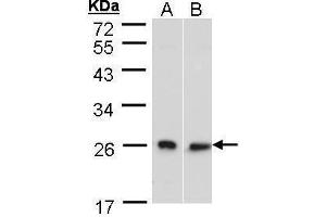 WB Image Sample (30 ug of whole cell lysate) A: HeLa S3 B: Molt-4 , 10% SDS PAGE antibody diluted at 1:500