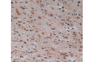 Used in DAB staining on fromalin fixed paraffin- embedded glioma tissue (GMFG 抗体  (AA 6-126))