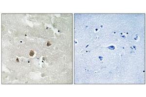 Immunohistochemical analysis of paraffin-embedded human brain tissue using MAP3K1 (Phospho-Thr1400) antibody (left)or the same antibody preincubated with blocking peptide (right). (MAP3K1 抗体  (pThr1402))