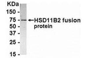 Western Blotting (WB) image for anti-Hydroxysteroid (11-Beta) Dehydrogenase 2 (HSD11B2) (AA 181-405) antibody (ABIN2468177) (HSD11B2 抗体  (AA 181-405))