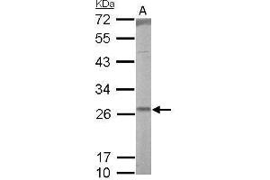 WB Image RALA antibody detects RALA protein by Western blot analysis. (rala 抗体  (Center))