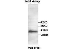 Western blot analysis of fetal kidney lysate, using AADACL2 antibody. (AADACL2 抗体  (AA 171-378))