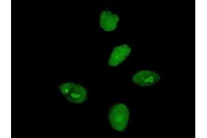 Immunofluorescence of monoclonal antibody to MKRN3 on HeLa cell. (MKRN3 抗体  (AA 437-507))