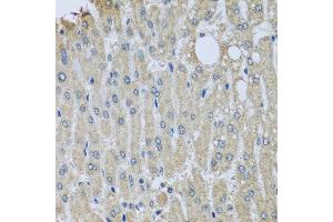 Immunohistochemistry of paraffin-embedded human liver injury using SYT11 antibody. (SYT11 抗体  (AA 37-200))
