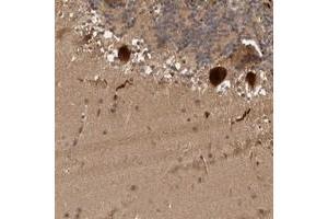 Immunohistochemical staining of human cerebellum with MLF1IP polyclonal antibody  shows strong cytoplasmic and nuclear positivity in Purkinje cells at 1:50-1:200 dilution. (MLF1IP 抗体)