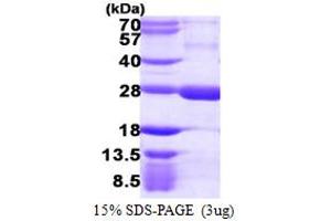 SDS-PAGE (SDS) image for Regulator of G-Protein Signaling 5 (RGS5) (AA 1-181) protein (His tag) (ABIN667524) (RGS5 Protein (AA 1-181) (His tag))