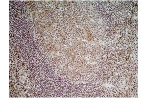 Immunohistochemistry (Frozen Sections) (IHC (fro)) image for anti-CD70 Molecule (CD70) antibody (ABIN316748) (CD70 抗体)
