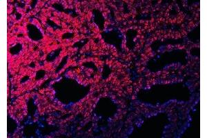 IF analysis of RBM15B using anti-RBM15B antibody (ABIN7600219). (RBM15B 抗体  (AA 164-890))