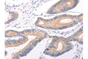 Immunohistochemistry (IHC) image for anti-Transient Receptor Potential Cation Channel, Subfamily C, Member 7 (TRPC7) antibody (ABIN7131495)