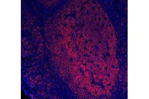 IF analysis of CD20/MS4A1 using anti-CD20/MS4A1 antibody (ABIN7599234).