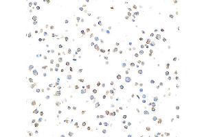 Immunocytochemistry (ICC) image for anti-Integrin, alpha X (Complement Component 3 Receptor 4 Subunit) (ITGAX) (AA 112-355) antibody (ABIN7449422)
