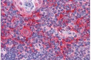 Human Thymus: Formalin-Fixed, Paraffin-Embedded (FFPE) (KLHL25 抗体  (Internal Region))