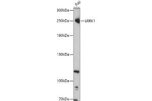 Western blot analysis of extracts of Raji cells, using LRRK1 antibody (ABIN7268231) at 1:1000 dilution. (LRRK1 抗体  (AA 10-90))