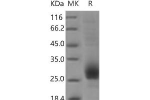 Western Blotting (WB) image for CD79b Molecule, Immunoglobulin-Associated beta (CD79B) protein (His tag) (ABIN7321125) (CD79b Protein (His tag))