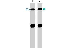 Western blot analysis of control (lane 1) and alkaline phosphatase-treated (AP) (lane 2) neonatal rat brain lysate (20 ug/lane). (Neural Wiskott-Aldrich syndrome protein (WASL) (N-Term) 抗体)