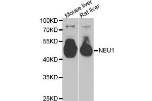 Western blot analysis of extracts of various tissues, using NEU1 antibody (ABIN5973721) at 1/1000 dilution. (NEU1 抗体)