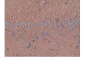 IHC-P analysis of Rat Brain Tissue, with DAB staining. (Aquaporin 4 抗体  (AA 179-314))