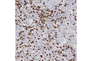 Immunohistochemical staining of human spleen with ZNF227 polyclonal antibody  shows strong cytoplasmic positivity in subsets of cells in red pulp at 1:500-1:100 dilution. (ZNF227 抗体)