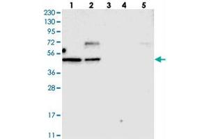 Western blot analysis of Lane 1: RT-4, Lane 2: U-251 MG, Lane 3: Human Plasma, Lane 4: Liver, Lane 5: Tonsil with TOX polyclonal antibody . (TOX 抗体)