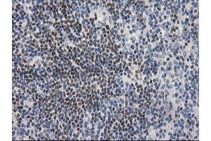Immunohistochemistry (IHC) image for anti-ADP-Ribosylation Factor GTPase Activating Protein 1 (ARFGAP1) antibody (ABIN1496680) (ARFGAP1 抗体)