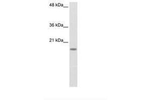 Image no. 1 for anti-Ribosomal Protein S14 (RPS14) (C-Term) antibody (ABIN203014) (RPS14 抗体  (C-Term))