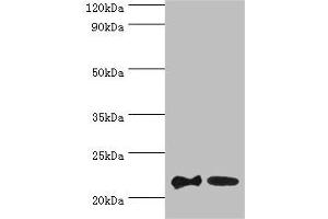 Western blot All lanes: SRI antibody at 2 μg/mL Lane 1: HepG2 whole cell lysate Lane 2: Hela whole cell lysate Secondary Goat polyclonal to rabbit at 1/10000 dilution Predicted band size: 22, 21 kDa Observed band size: 22 kDa (SRI 抗体  (AA 1-198))