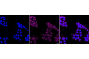 anti-Cell Division Cycle Associated 3 (CDCA3) antibody