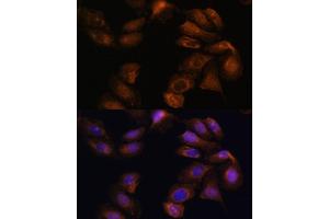 Immunofluorescence (IF) image for anti-Roundabout, Axon Guidance Receptor, Homolog 1 (ROBO1) (AA 1452-1651) antibody (ABIN7270110)