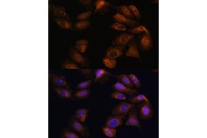 Immunofluorescence analysis of U-2 OS cells using ROBO1 Polyclonal Antibody (ABIN7270110) at dilution of 1:100 (40x lens). (ROBO1 抗体  (AA 1452-1651))