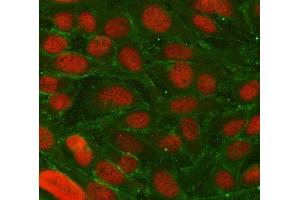 IF analysis of TRIM36 using anti-TRIM36 antibody (ABIN7600059) and anti-Tubulin Alpha antibody (ABIN7600339). (TRIM36 抗体  (AA 143-642))