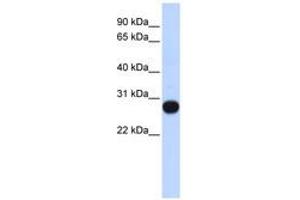Image no. 1 for anti-Transcription Elongation Factor A (SII)-Like 4 (TCEAL4) (AA 107-156) antibody (ABIN6741080) (TCEAL4 抗体  (AA 107-156))