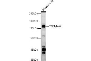 Western blot analysis of extracts of Mouse lung, using TBK1/NAK antibody (ABIN3016267, ABIN3016268, ABIN3016269 and ABIN6219678) at 1:1000 dilution. (TBK1 抗体  (AA 440-729))