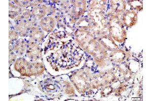 Formalin-fixed and paraffin embedded rat kidney labeled with Rabbit Anti-NTCP/SLC10A1 Polyclonal Antibody, Unconjugated  at 1:200 followed by conjugation to the secondary antibody and DAB staining (SLC10A1 抗体  (AA 21-120))