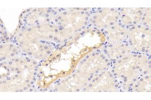 Immunohistochemistry (IHC) image for anti-Complement Fragment 3a (C3a) (AA 672-748) antibody (ABIN7439951)
