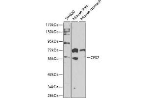 Western blot analysis of extracts of various cell lines, using CES2 antibody (ABIN6134283, ABIN6138436, ABIN6138437 and ABIN6217717) at 1:1000 dilution. (CES2 抗体  (AA 310-410))