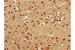 Immunohistochemistry of paraffin-embedded human brain tissue using ABIN7164089 at dilution of 1:100 (PRDM16 抗体  (AA 448-683))