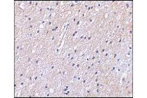 Immunohistochemical staining of human brain tissue using AP30592PU-N at 2. (SLC9A1 抗体  (Center))