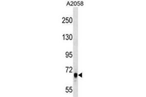 ARHGEF5 Antibody (C-term) western blot analysis in A2058 cell line lysates (35µg/lane). (ARHGEF5 抗体  (C-Term))