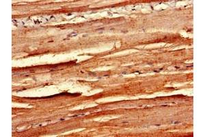 Immunohistochemistry of paraffin-embedded human skeletal muscle tissue using ABIN7159984 at dilution of 1:100 (MAPK12 抗体  (AA 314-367))