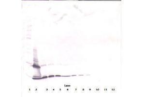 Image no. 2 for anti-PDGF-BB Homodimer antibody (ABIN465590) (PDGF-BB Homodimer 抗体)