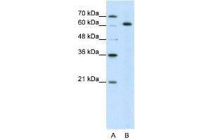 WB Suggested Anti-SNRP70  Antibody Titration: 5. (SNRNP70 抗体  (N-Term))