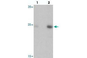 Western blot analysis of DRGX in rat liver tissue with DRGX polyclonal antibody  at (lane 1) 1 and (lane 2) 2 ug/mL. (DRGX 抗体  (C-Term))