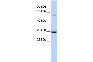 WB Suggested Anti-LPCAT1 Antibody Titration:  0. (LPCAT1 抗体  (Middle Region))