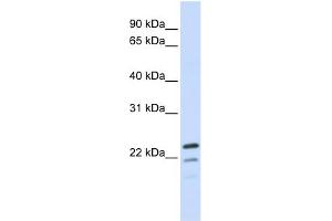 REEP1 antibody used at 1 ug/ml to detect target protein. (Receptor Accessory Protein 1 抗体  (Middle Region))