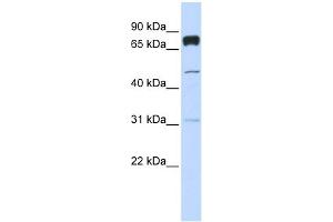 WB Suggested Anti-PLEKHA4 Antibody Titration:  0. (PLEKHA4 抗体  (Middle Region))