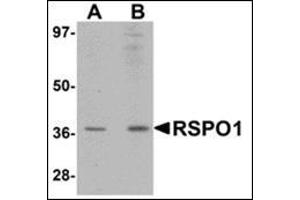 Western blot analysis of RSPO1 in rat spleen tissue lysate with this product at (A) 1 and (B) 2 μg/ml. (RSPO1 抗体  (N-Term))